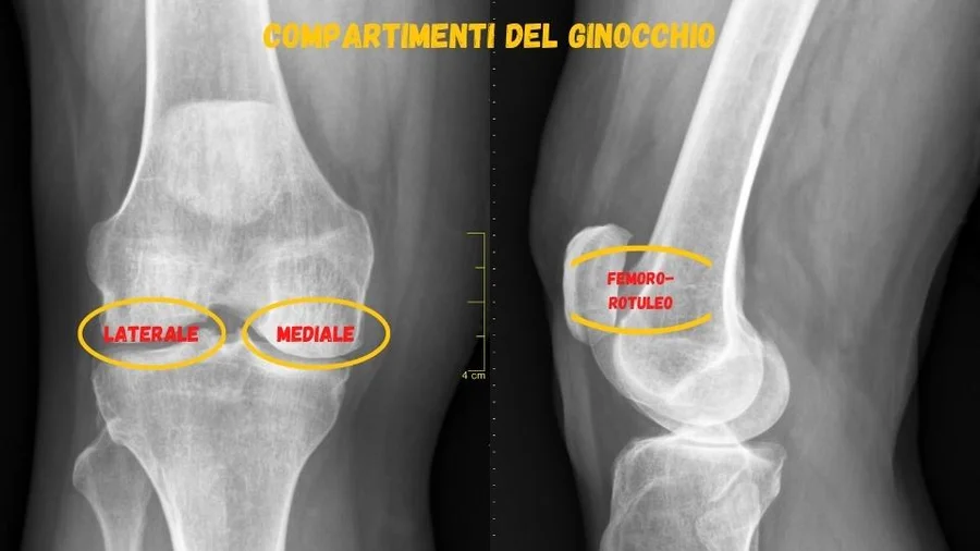 Compartimenti del ginocchio compartimenti del ginocchio