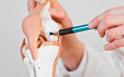 Rigenerare la cartilagine con le nanofratture